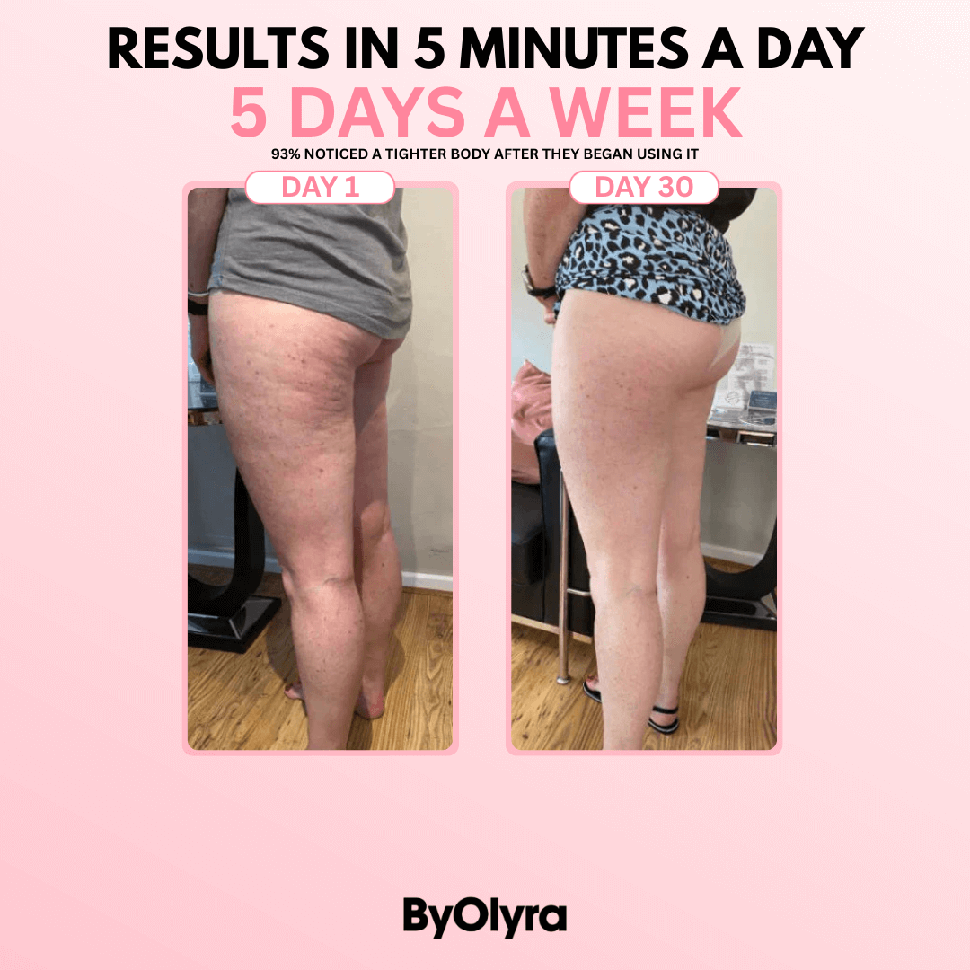 ByOlyra™ Cellulite Massager