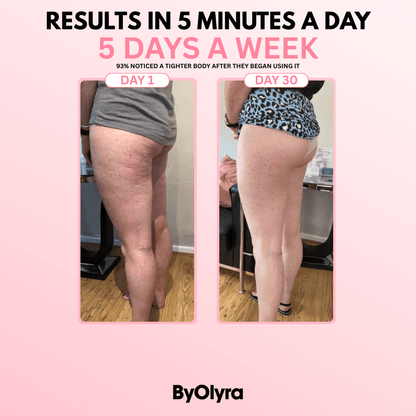 ByOlyra™ Cellulite Massager